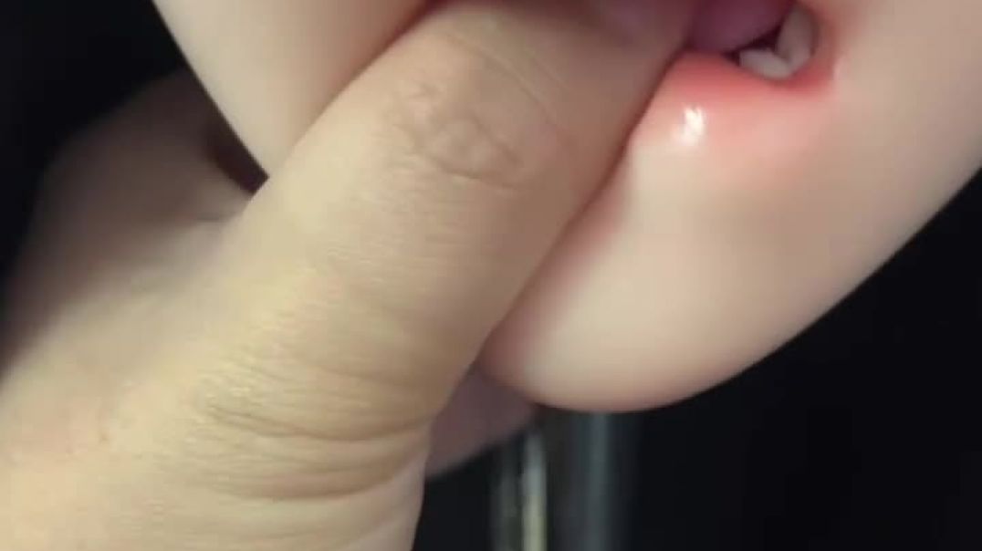 ⁣ROS mouth video C (3)